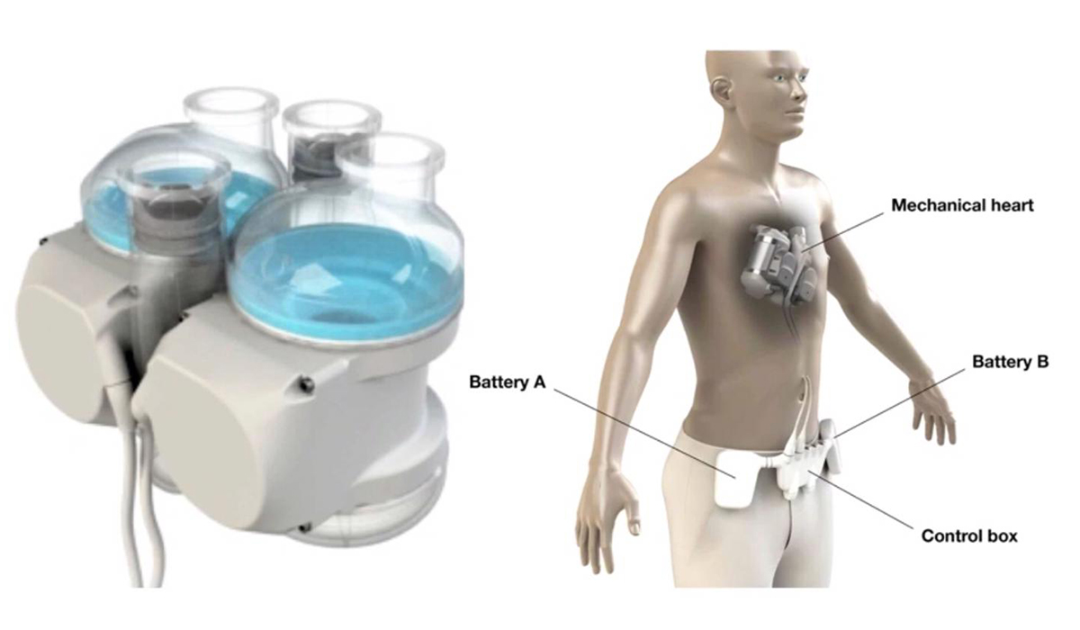Realheart TAH - a "real" artificial heart